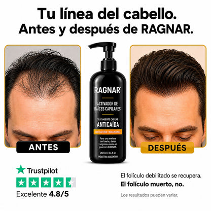 Sistema Activador de Raíces