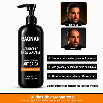 Sistema Activador de Raíces